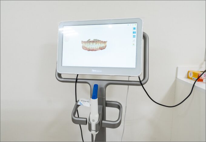 iTero エレメント口腔内スキャナー